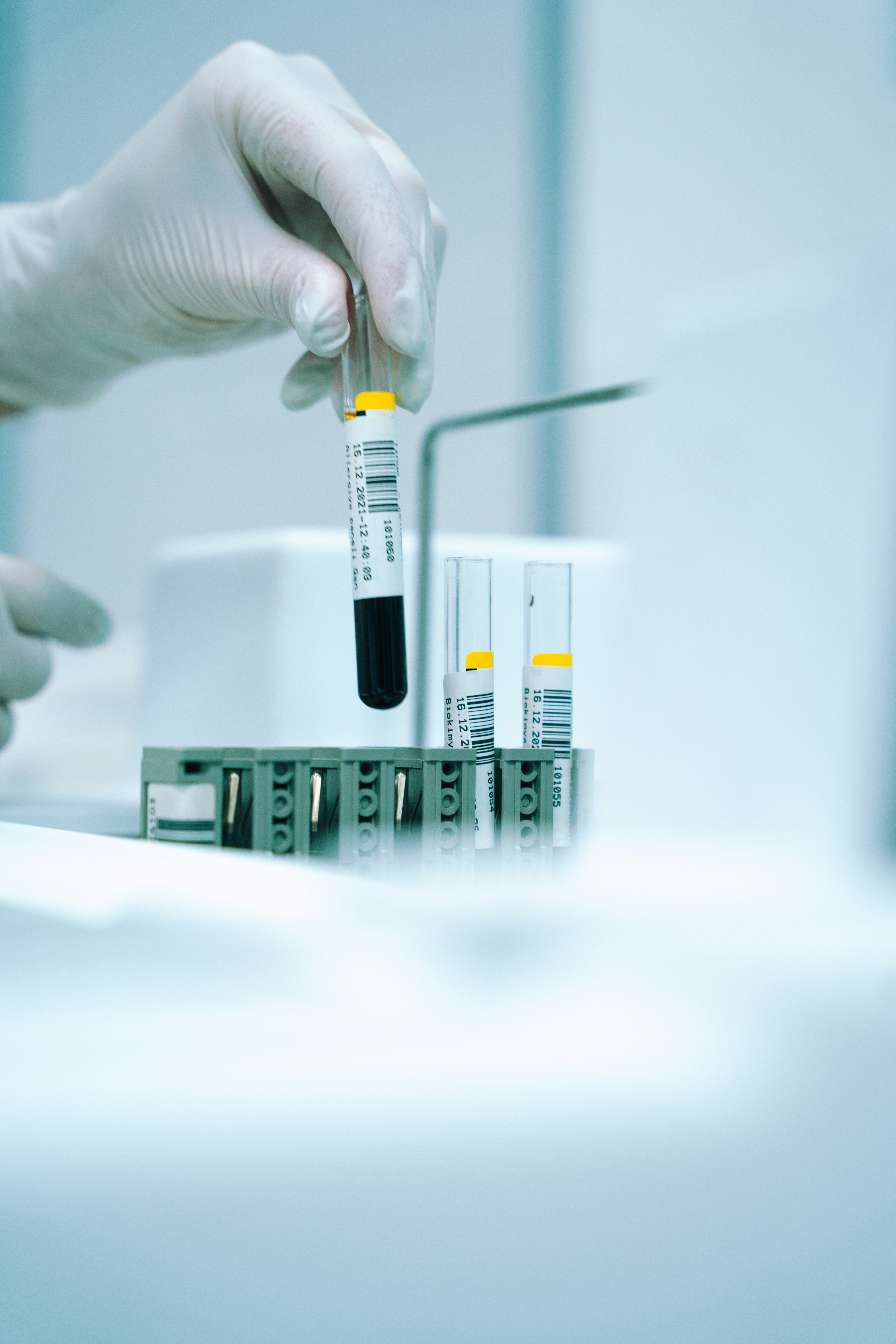 Exame de sangue para Alzheimer chega ao Brasil por R$ 3 mil